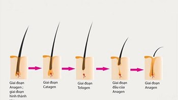 Quá Trình Mọc Tóc Diễn Ra Như Thế Nào?